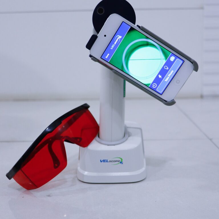 Velscan Machine for Pre-cancer Detection