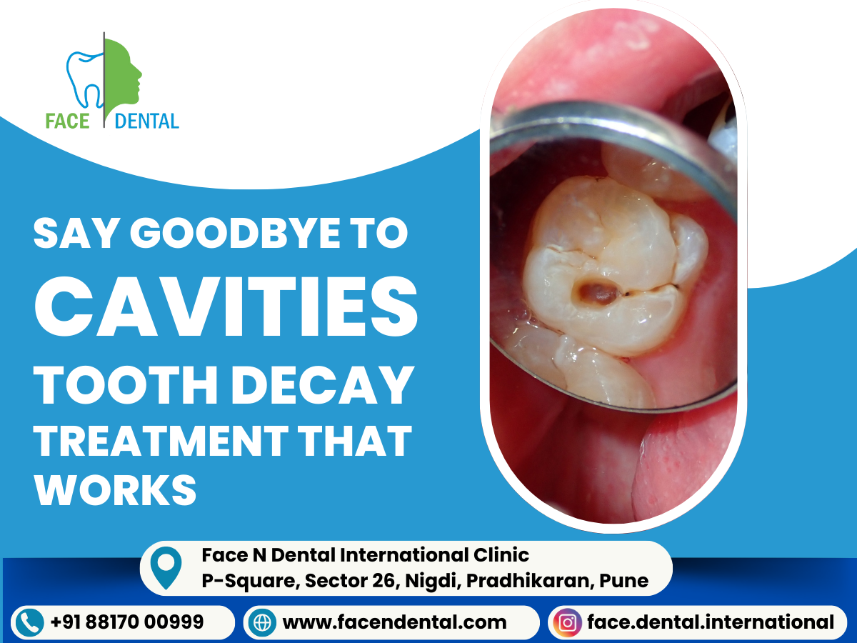 Face N Dental International Clinic tooth decay treatment in Pimpri Chinchwad